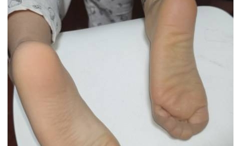 桔子摄影 模拍丝足图片 母女双双展示诱人肉丝短图 含脚底大特写（107p）